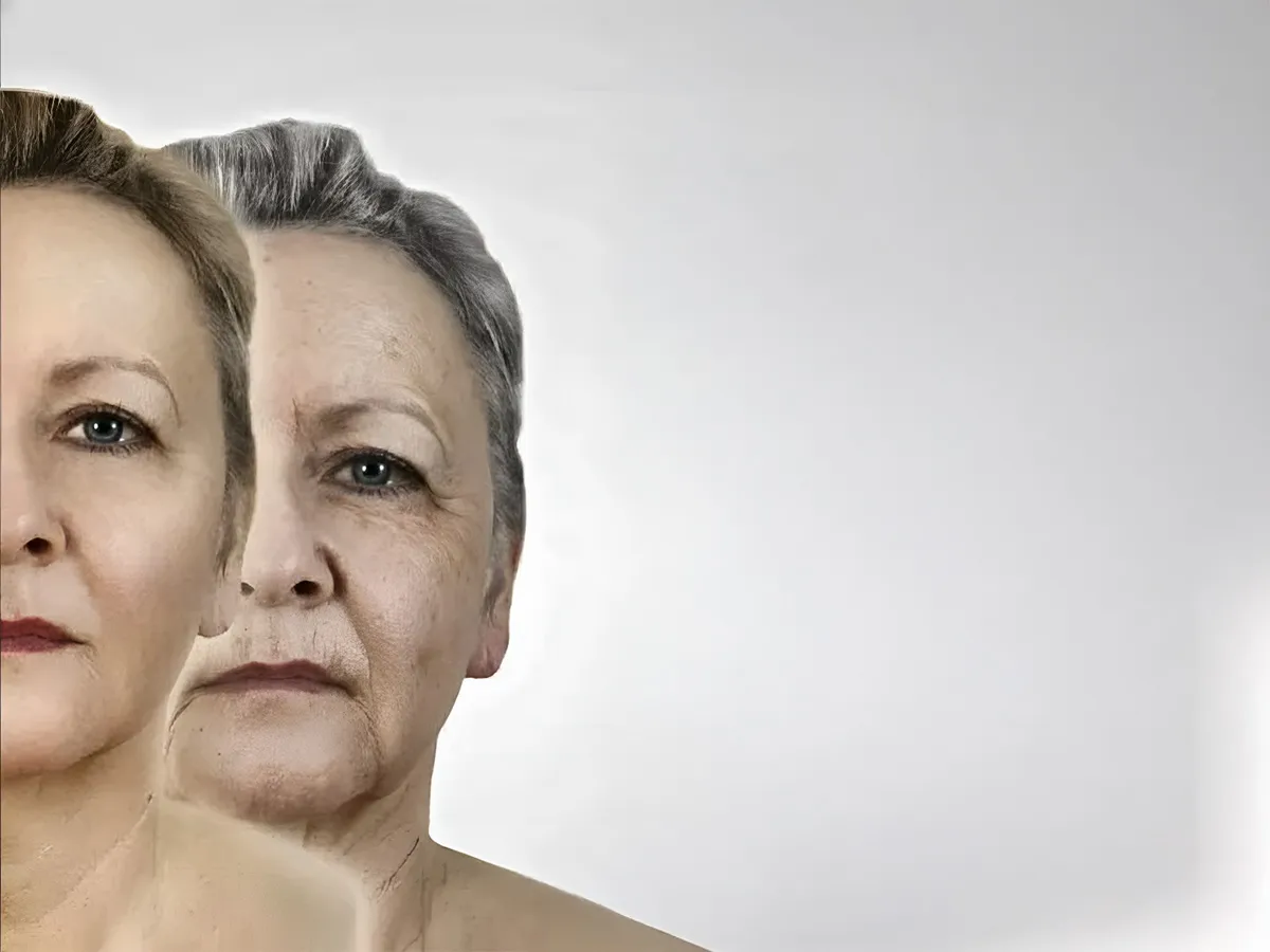 Yüz Germe (Face Lift) - Görsel 1