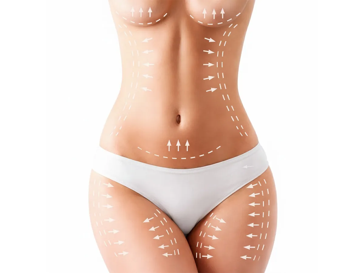 Liposuction (Yağ Aldırma) - Görsel 2