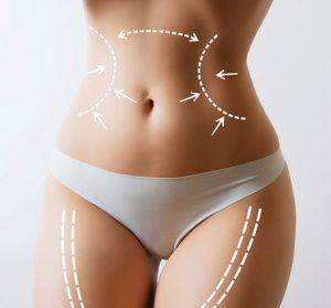 liposuction ankara
